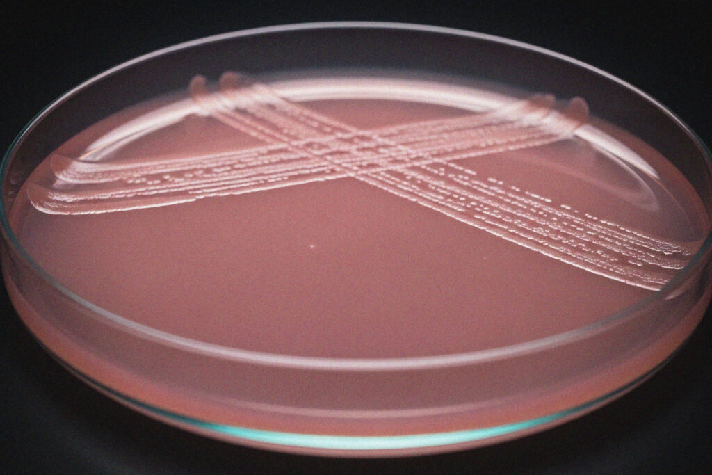 A petri dish with pink agar medium, showing streaked bacterial colonies forming lines in a X pattern on the surface.